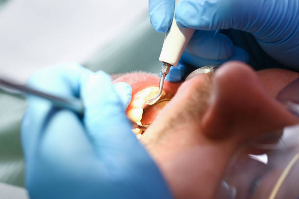 Best Pediatric Emergency Dentist in Piedmont, OK