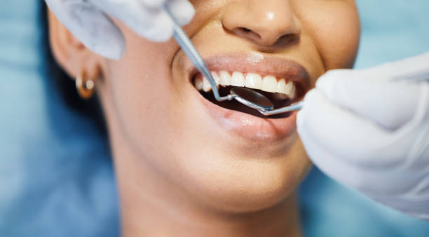 Best Emergency Tooth Extraction in Piedmont, OK