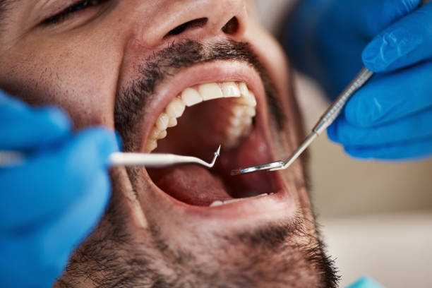 Best Emergency TMJ Treatment in Piedmont, OK